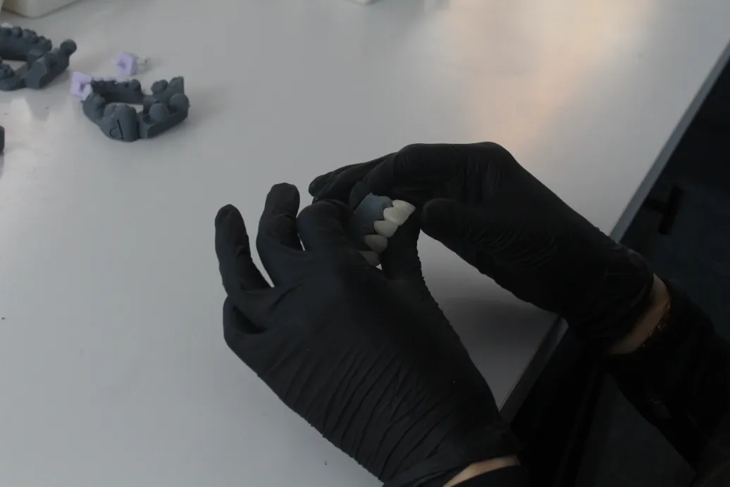 dental lab closeup dental model